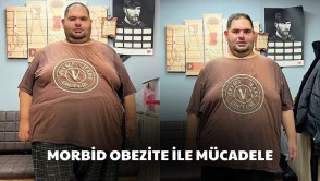 Morbid obeziteyle mücadelede Türkiye'de bir ilke imza atıyoruz